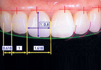 相対的歯冠長イメージ